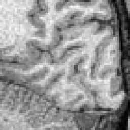 [Left Cortical Hemisphere]