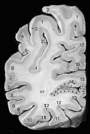 [Ocipital Lobe]