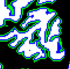 [Gray Matter Segmentation]